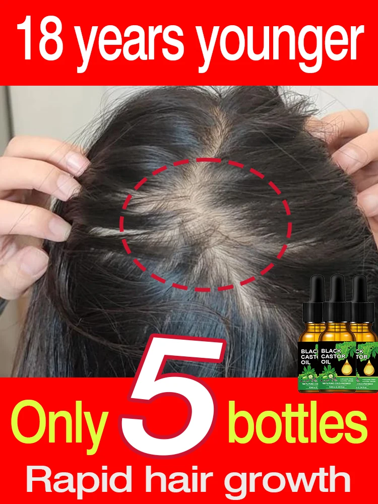 

Масло для роста волос, ямайская кожа головы, густая, укрепляющая, против выпадения волос, восстанавливающая, Питательная жидкость