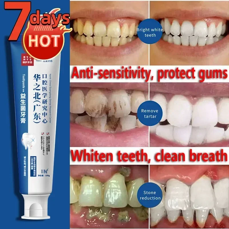 

New Sdottor Repair Toothpaste Of Cavities Dental Plaque Removal Whitening Toothpaste Calcioff Scratch Preventing Decayed Gums De