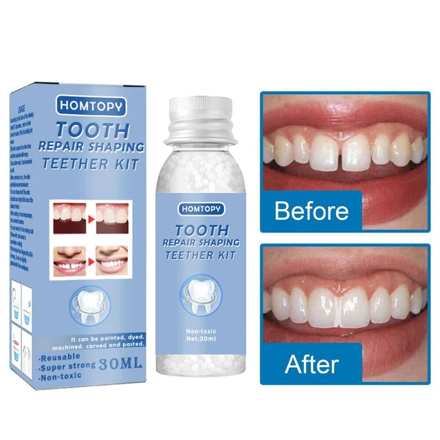 Tooth Repair Beads Tooth Glue Temporary Dental Glue for Teeth Filling  Reusable