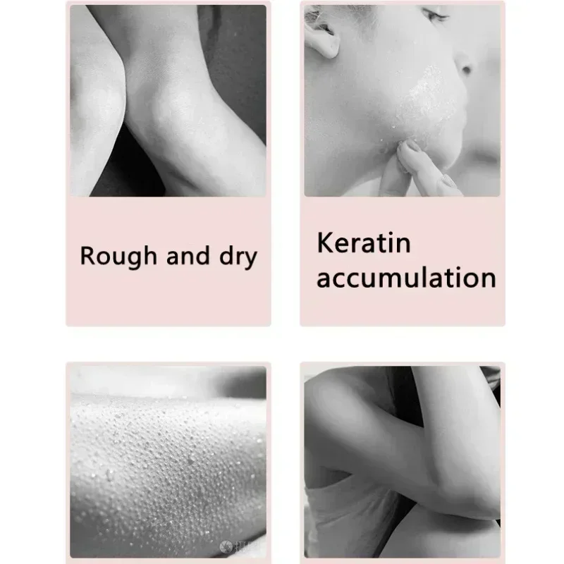 Facial Exfoliating Body Scrub 140g Whitening Moisturizing Peeling Cream Gel Face Scrub Clean Pores Tender and Moist