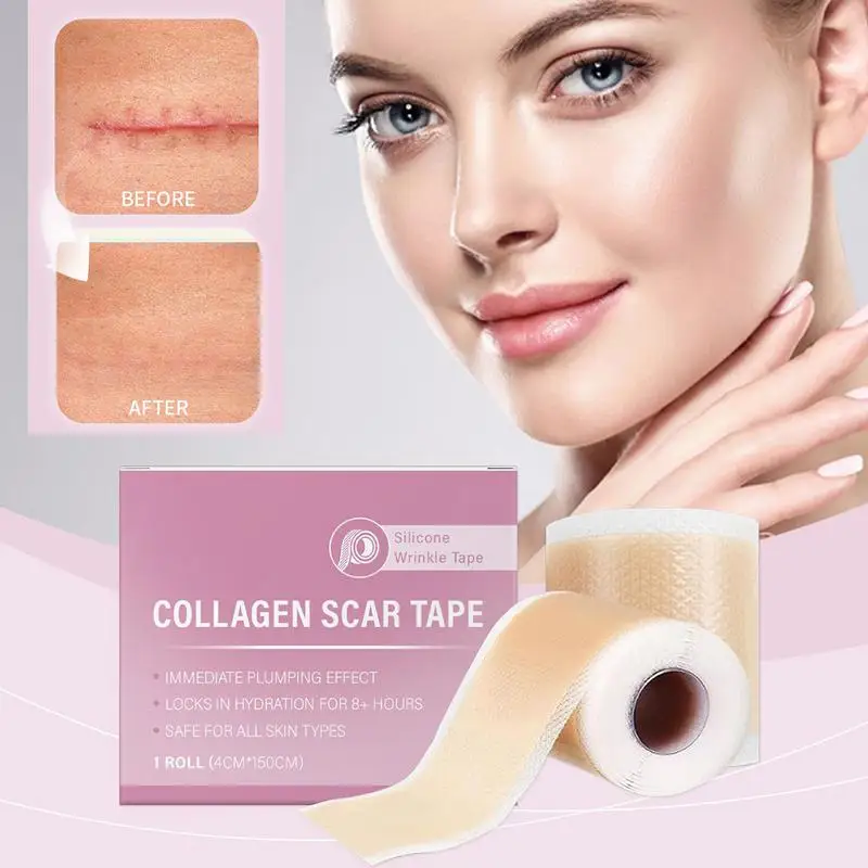 hot sale 1 Roll Silicone Scar Sheet Painless Scar Repair Tape Roll Effective Scar Waterproof Breathable Ear Beauty Sticker