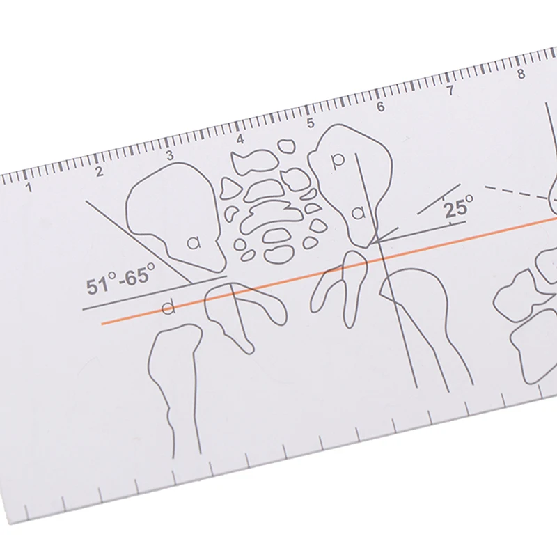 Plastic Goniometer Angle Ruler Rule Joint Orthopedics Tool Instruments Medical Spinal Angle Ruler Finder Measuring Tool Digital Angle Protractor Angle Measuring Tool Angle Protractor