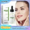 Azelaic Acid Serum Acne Remover Shrinking Pore Invisible Oil Control Brighten Soothing Firm Moisturizing Facial Essence Liquid 1