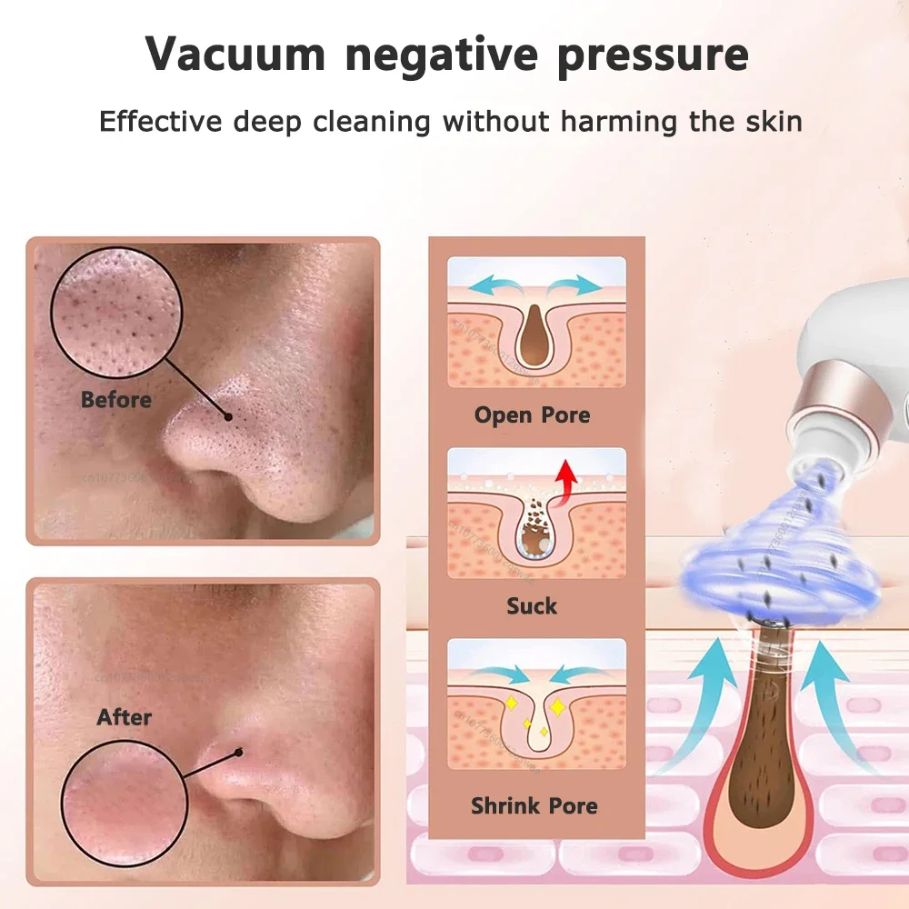 portable skincare device