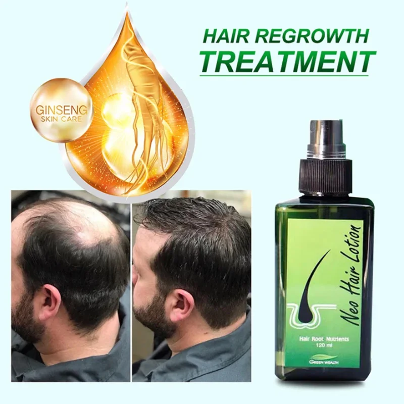 

120ml Hair Growth Oil Original Neo Hair Lotion Made In Thailand Prevents Hair Loss Scalp Treatment Essence Spray For Man Woman