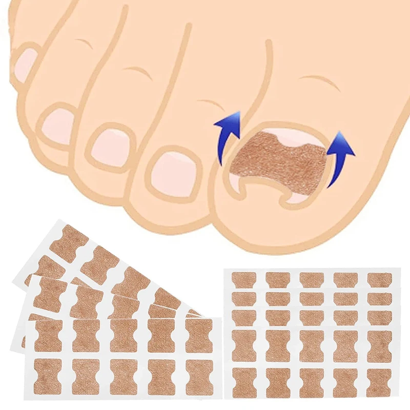 Toe Corrector Manicure Pedicure Tools Ingrown Toenail Straightening Clip Stainless Steel Treatment Onyxis Correction