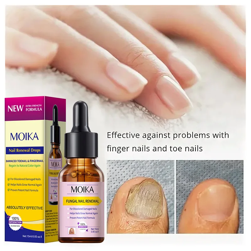 Fungal nail treatment serum foot nail fungus removal repair gel anti infection paronychia onychomycosis foot nails care essence