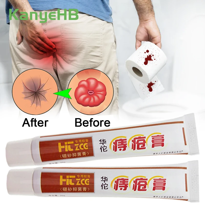 2Pcs Hemorrhoids Removal Treatment Ointment Internal External Hemorrhoid Anal Fissure Pain Relief Chinese Medicine Cream A248