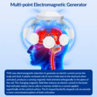 ZJZK Deep Rtms For Alcoholism Tms And ADhd Obsessive-Compulsive Disorder (OCD) Post-Traumatic Stress Disorder (PTSD) Anxiety 2