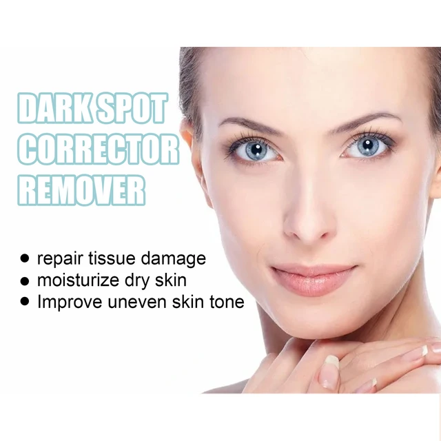 EELHOE Whitening Freckle Cream Nicotinamide Dark Spot Remover Skin Care Moisturizing Brighten Anti-aging Fade Spot Face Beauty