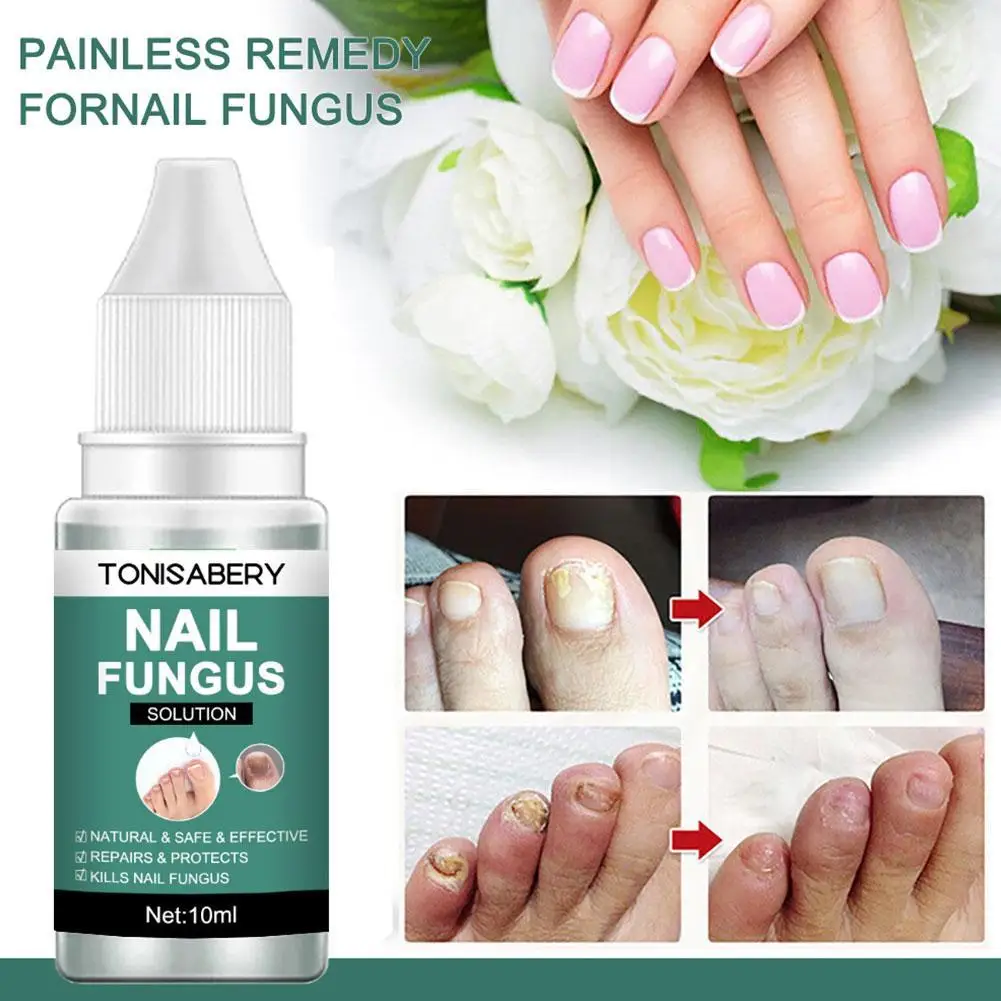 

10ml Toenail Fungus Treatment Strength Care Nail Repair Solution Feet Care Essence For Finger Toenail R8f4