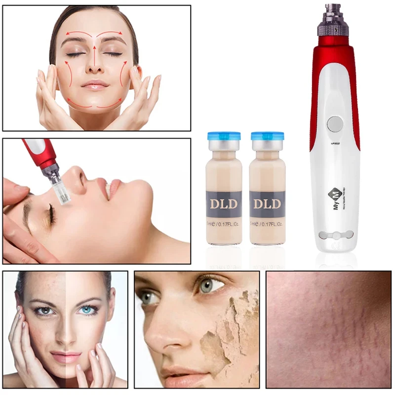 Рисунок 4 - Беспроводная профессиональная ручка MYM Microneedle