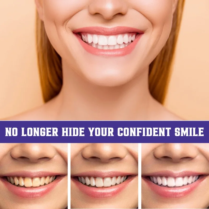 Smilekit V34 Purple Toothpaste Color Corrector Teeth Cleans Oral Cavity Keep Refreshing Yellow Stain Reduction Whitening Product