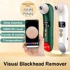 Visual Blackhead Remover Facial Deep Clean Machine Blackheads and Acne Remover Heated Face Extractor Electric Blackhead Sucker 1