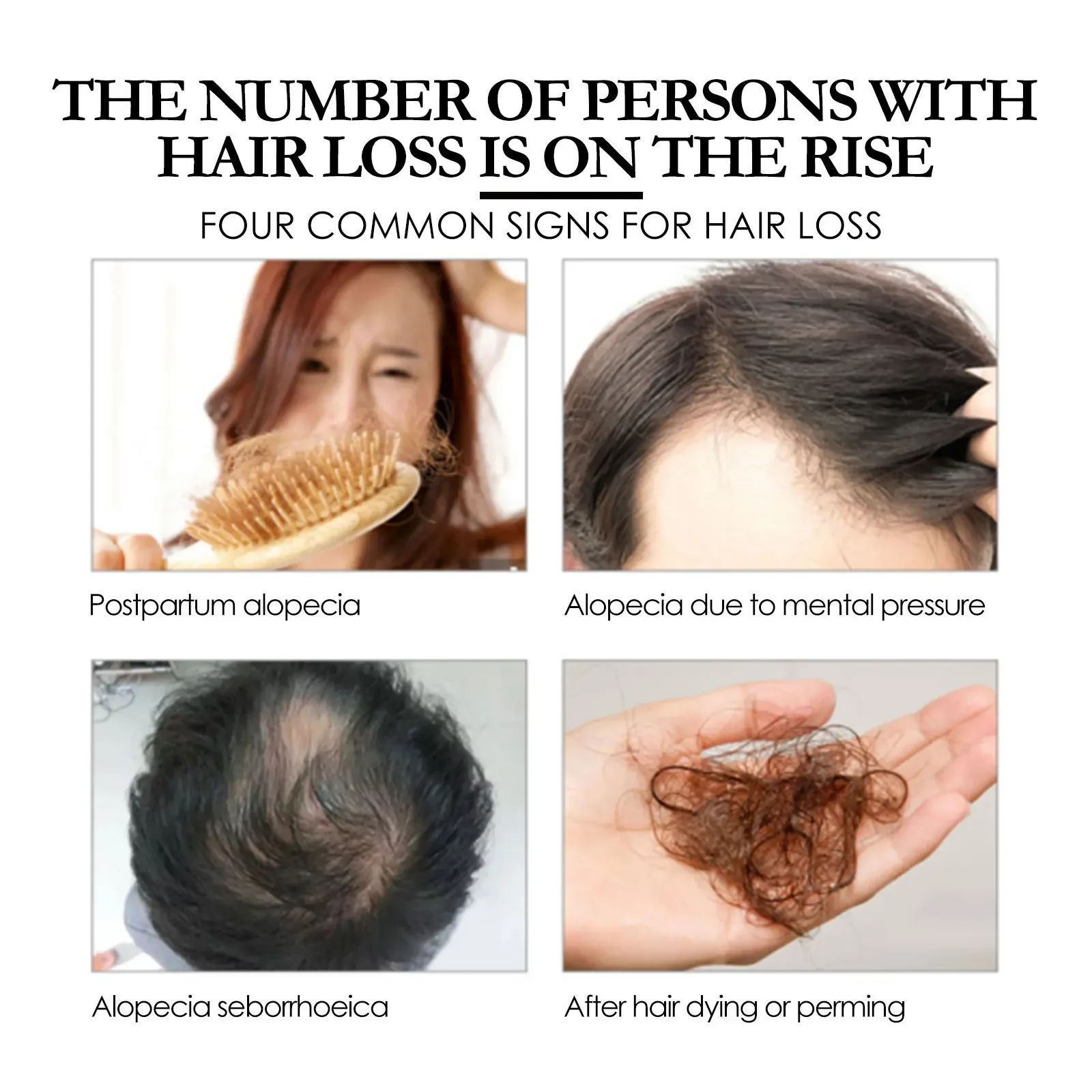 

Спрей для волос Eelhoe Batana, 30 мл, глубокое увлажнение, восстановление кожи головы, сильная и жесткая фиксация волос, плотность волос