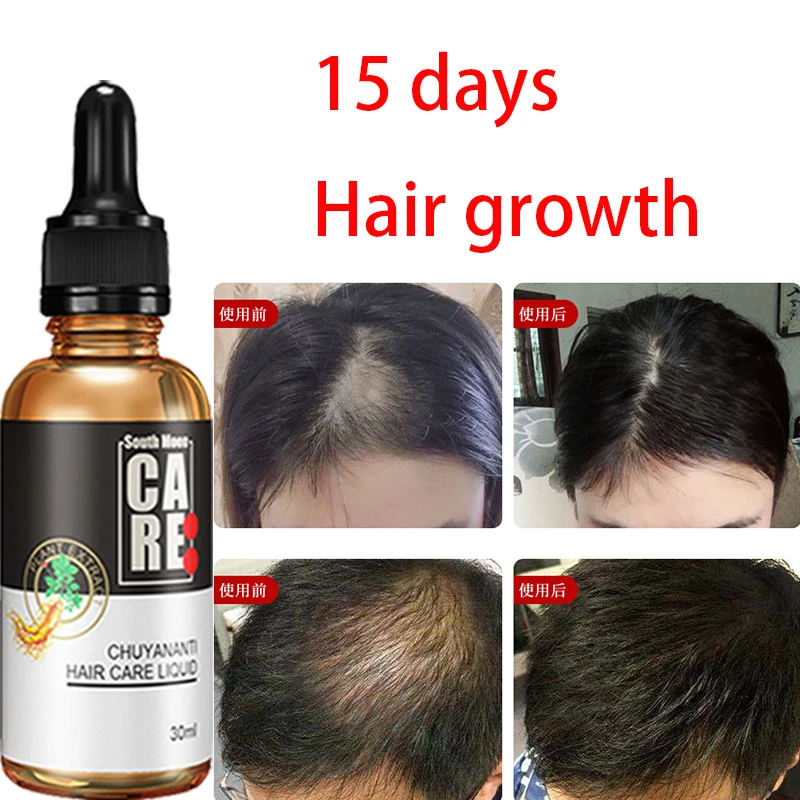 

Hair Nutrient Solution Hair Nourishing Root Hair Nourishing Solution Anti shedding essence