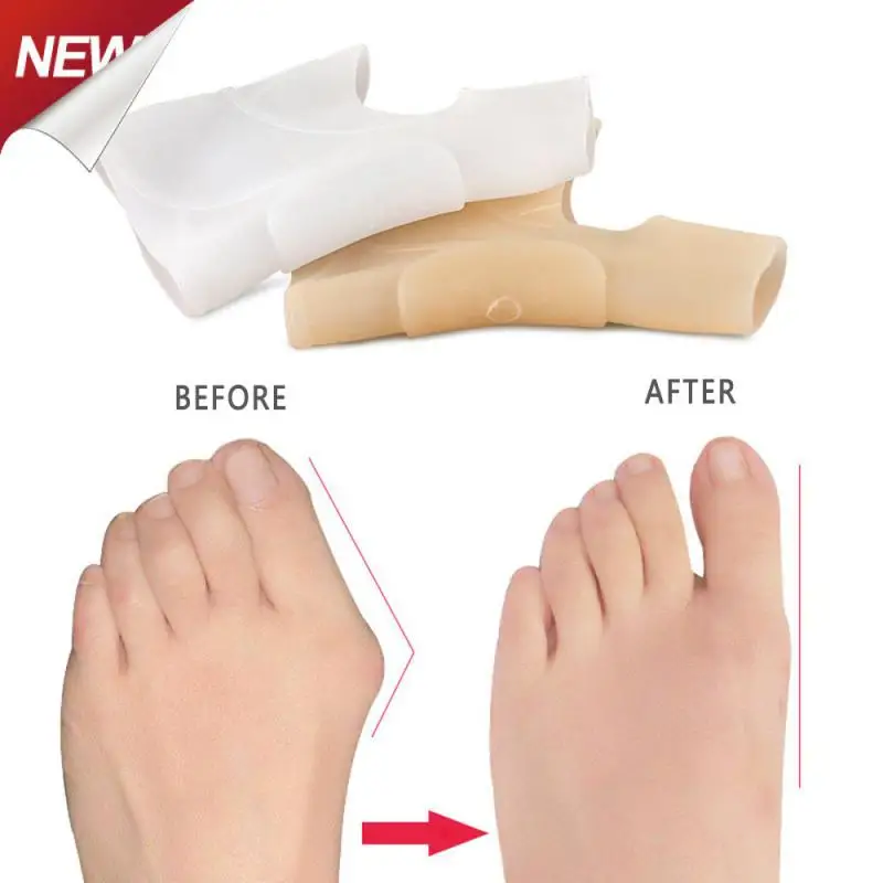 Силиконовый разделитель для пальцев ног, устройство для регулировки большого пальца ног при вальгусной деформации