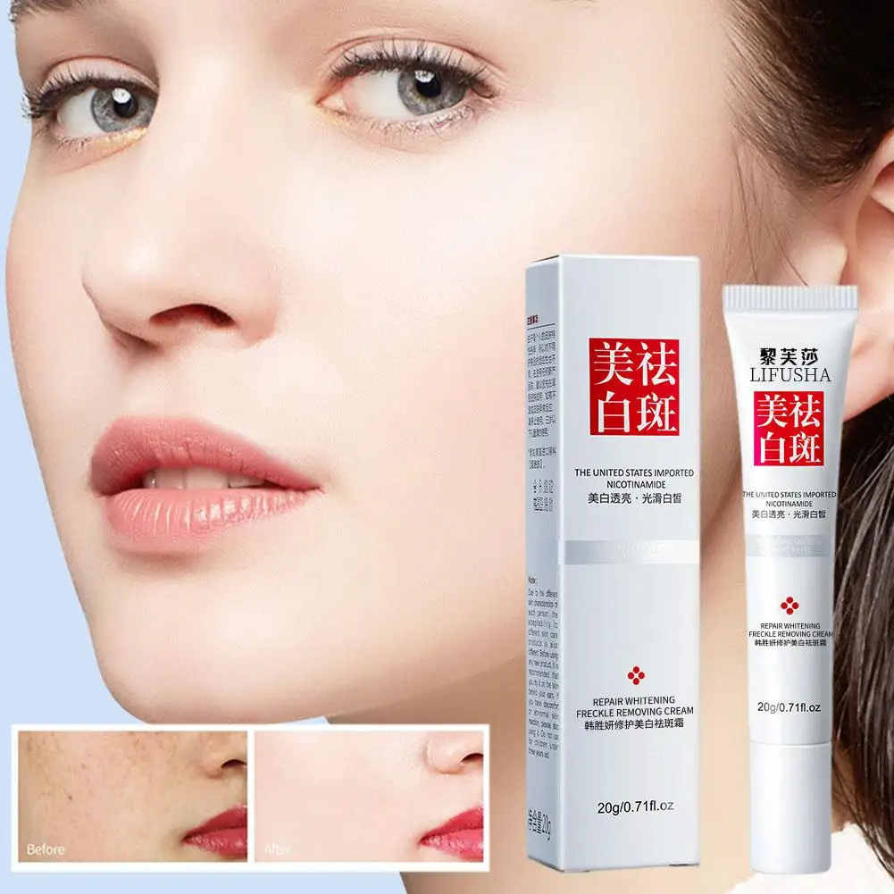 

20g Chinese Face Cream To Remove Freckles And Dark Whitening Skin Spots Whitening Powerful Care Cream Cream Facial M8Y8