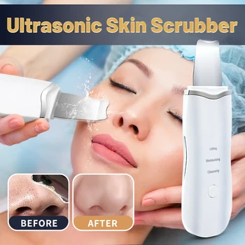 Ultrasonic Skin Scrubber Cleaner 1