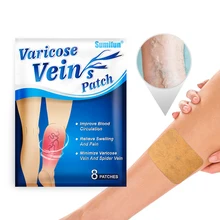

8pcs Varicose Veins Patch Phlebitis Vasculitis Treat Sticker Thigh Spider Removal Pain Relief Plaster Remove Vascular Blockage