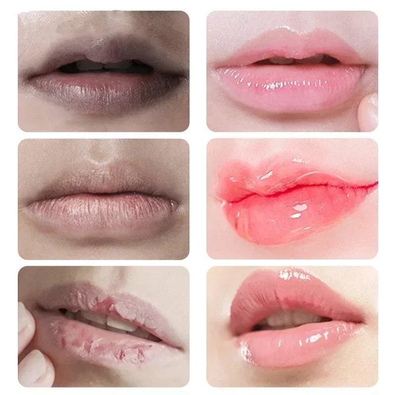 Fast Lightening Pink Mouth Lips Serum Bleaching Permanent Pinkish Moisturizing Lighten Dark Lip Balm Gloss Lipstick Lip Mask 3
