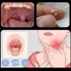 Tonsil Stone Remover Tool Suction Ball Manual Style Remover Mouth Cleaning Care Tool Ear Wax Tonsil Stone Remover Cleaning Tool 2