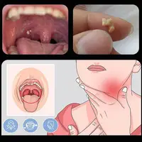 Tonsil Stone Remover Tool Suction Ball Manual Style Remover Mouth Cleaning Care Tool Ear Wax Tonsil Stone Remover Cleaning Tool 2