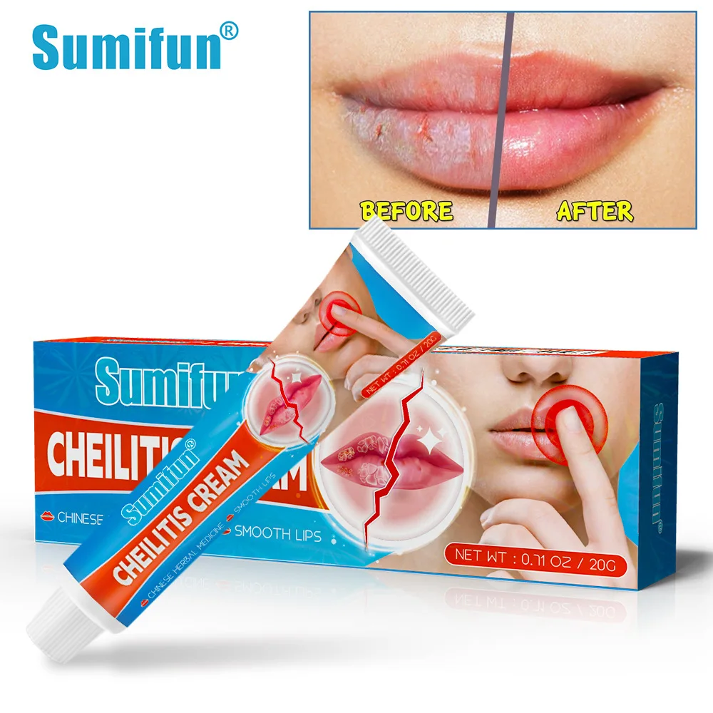 Mouth care,lip gloss,Makeup,make up,Lipstick, Cross border Lipitis Cream Lip Care Skin Topical Cream