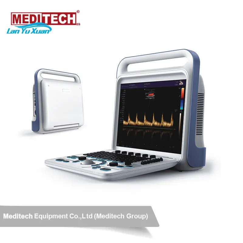 Рисунок 3 - Портативный фотоаппарат для фото-и