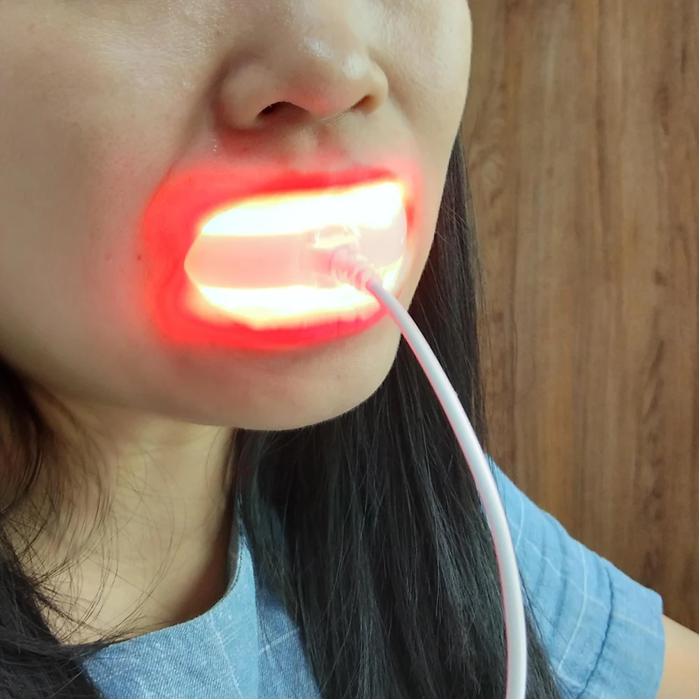 Red Light laser regenerative Therapy Device for Gum Disease Treatment Relieves Pain teeth sensitive