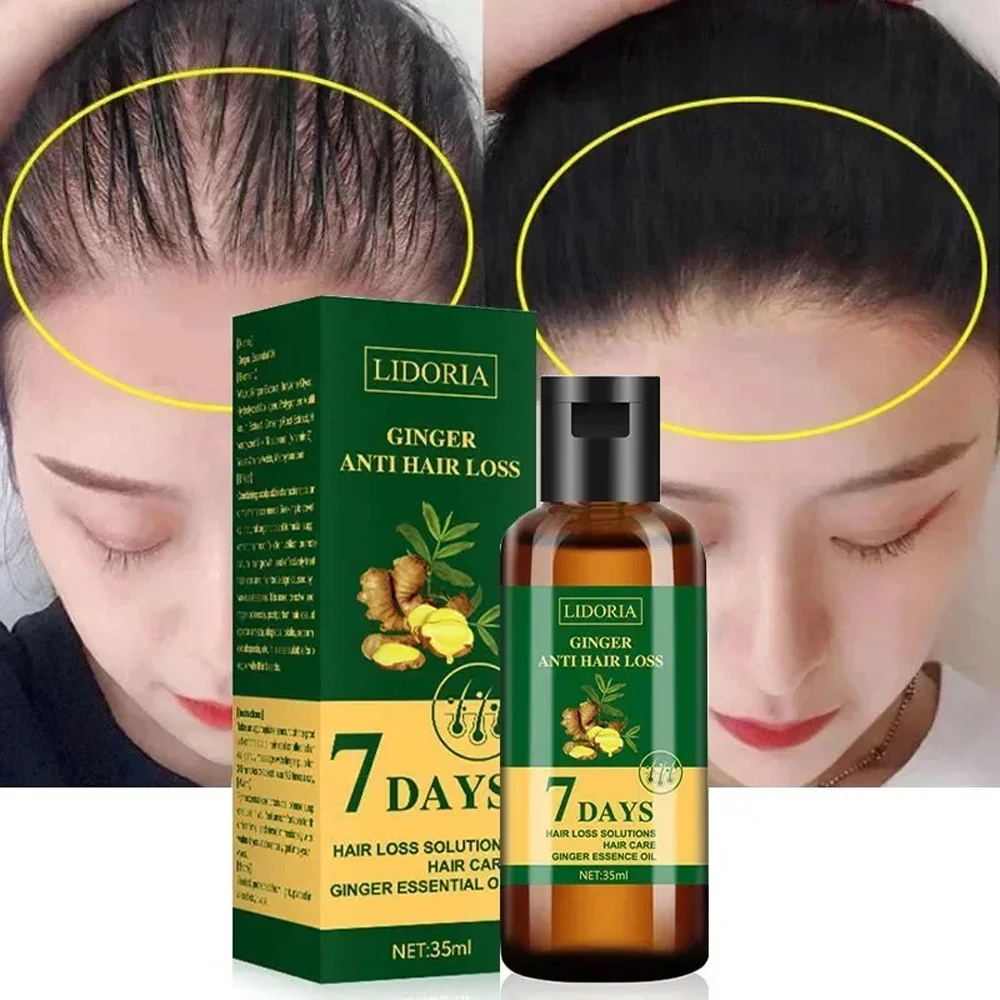 

Ginger Hair Growth Essential Oil Anti-loss Hair Regrowth Serum Fast Growth Prevent Baldness Treatment Alopecia Repair Hair Care