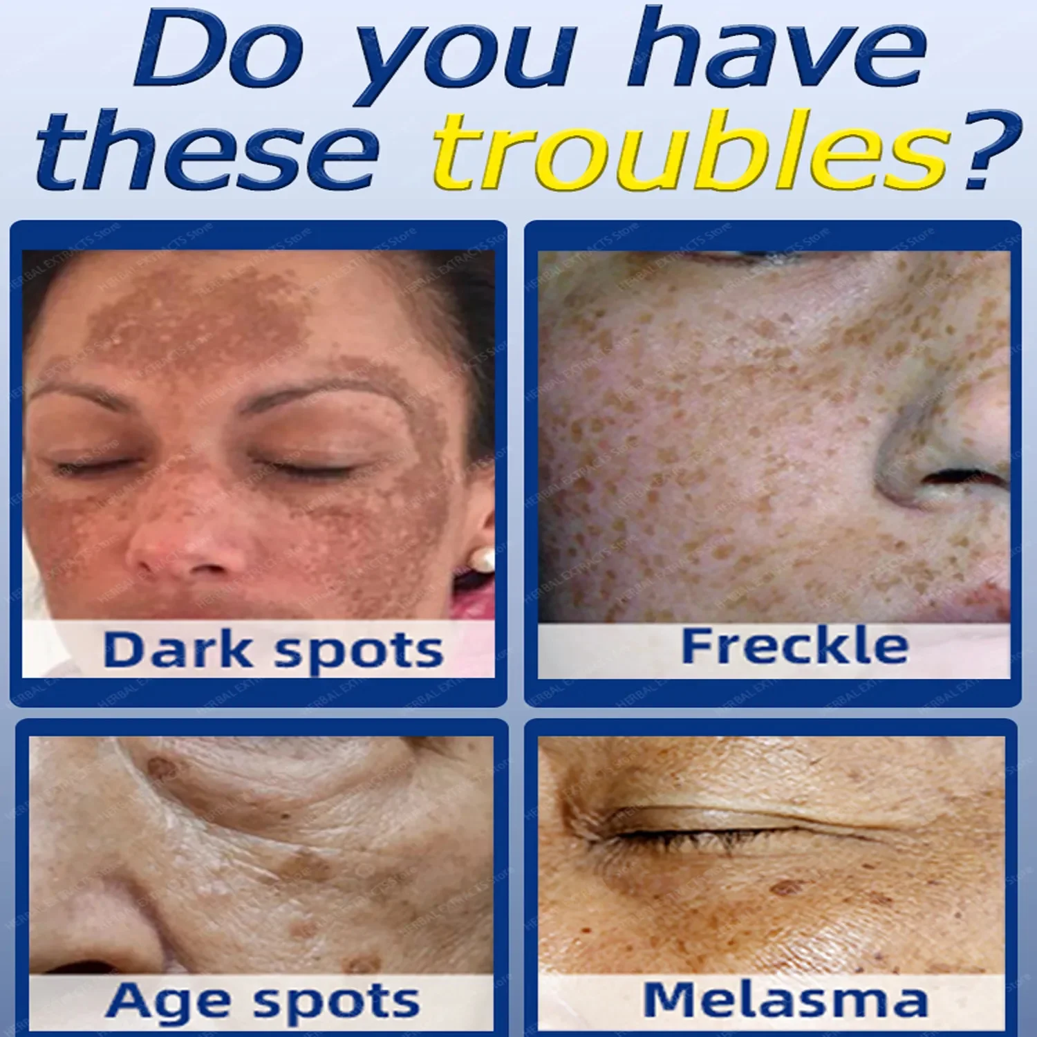 Glutathione Whitening Freckle Face Cream Remove Dark Spots Lighten Melasma Melanin Fade Acne Scars Anti-Aging_voghion.com