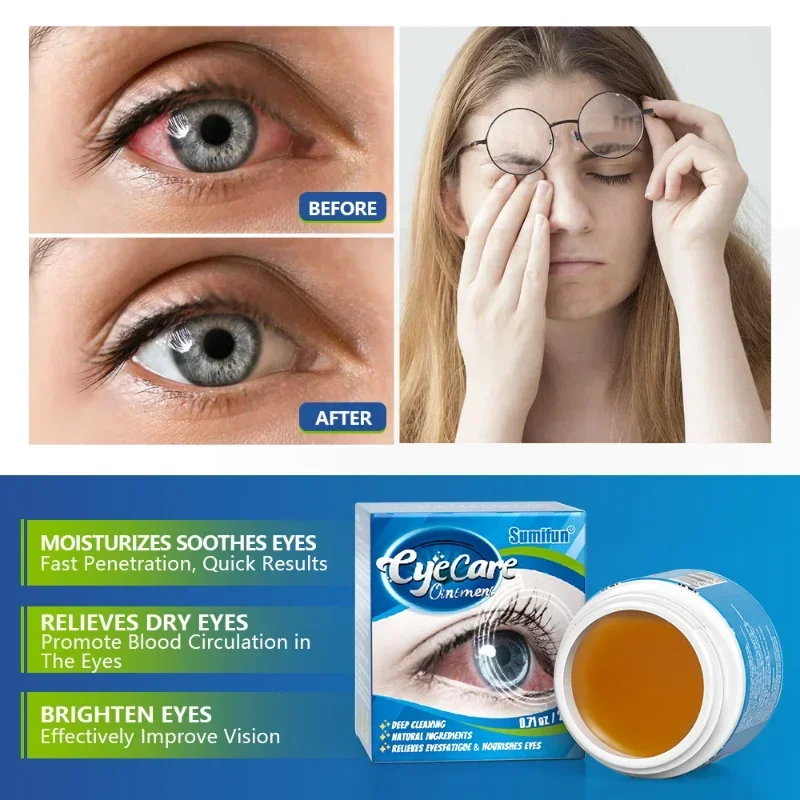 Eye Cream Protection vision Relief fatigue Itchy Dry Eyes At Night Remove Red Blood silk Moisturizing Bright Eyes care Ointment