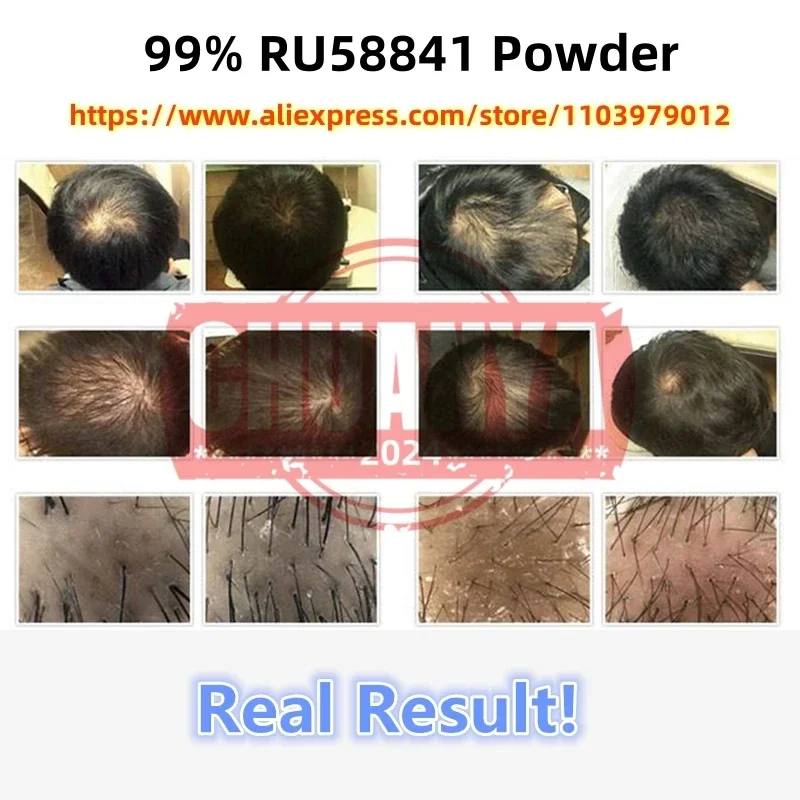 100% Ru58841,Hair Regrowth Stimulation, Anti Hair Loss[Latest Date]