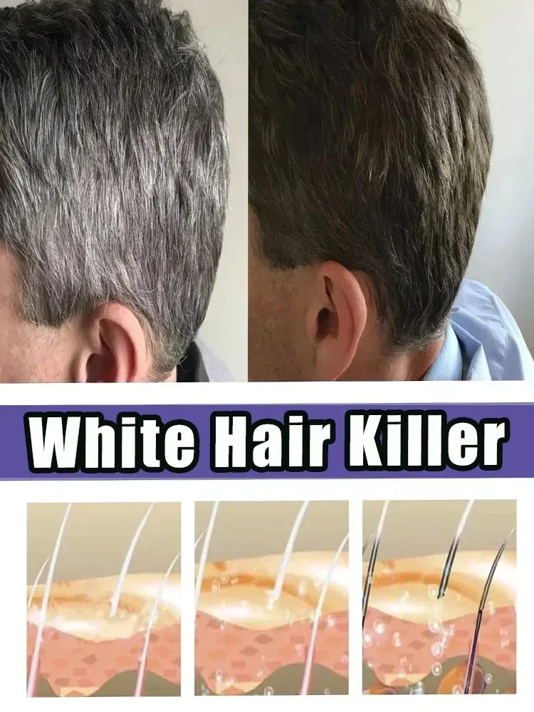 Black hair liquid removes grey hair in old age Natural anti-white ahair effective for natural ahair color and restore black hair color restorer