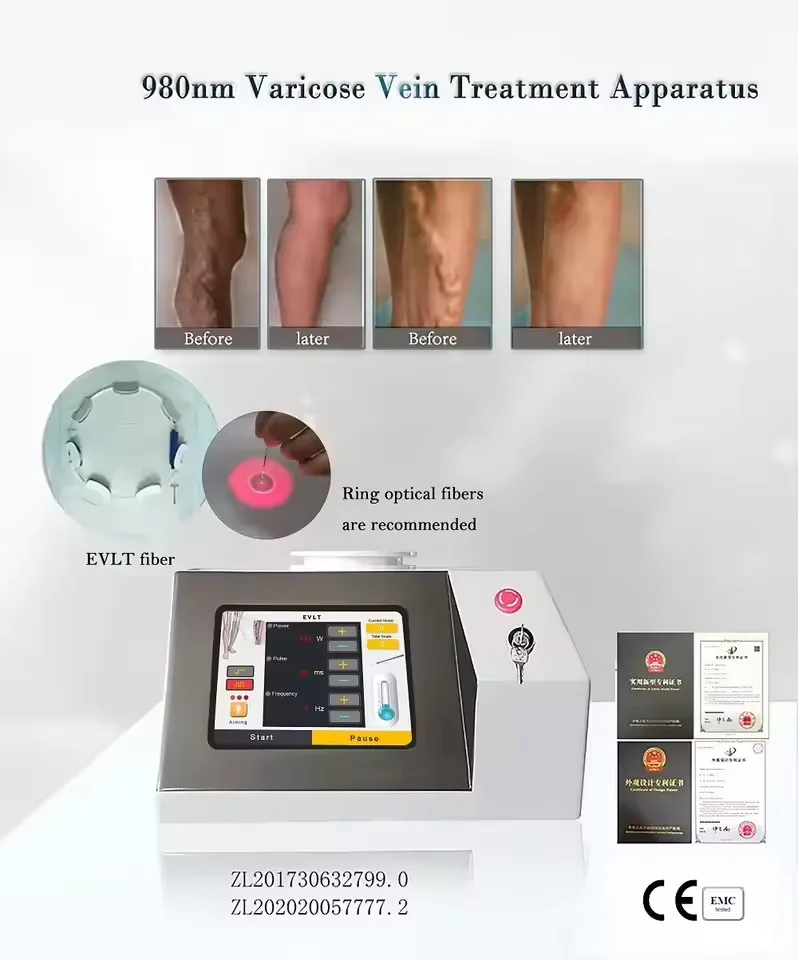 Máquina de liposucción láser de diodo para esculpir el cuerpo, adelgazar, lipólisis, reducción de grasa, lifting facial, endolifting.