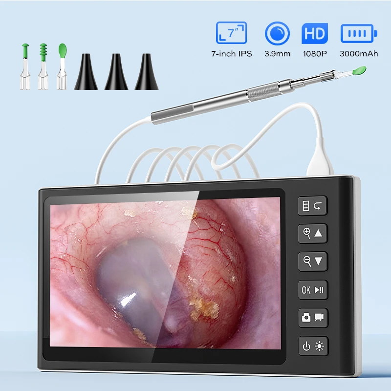 7인치 IPS 화면 내시경(스탠드 포함), 3.9mm 1080P HD 이경 귀 내시경 분리형 디자인(귀지 제거용)