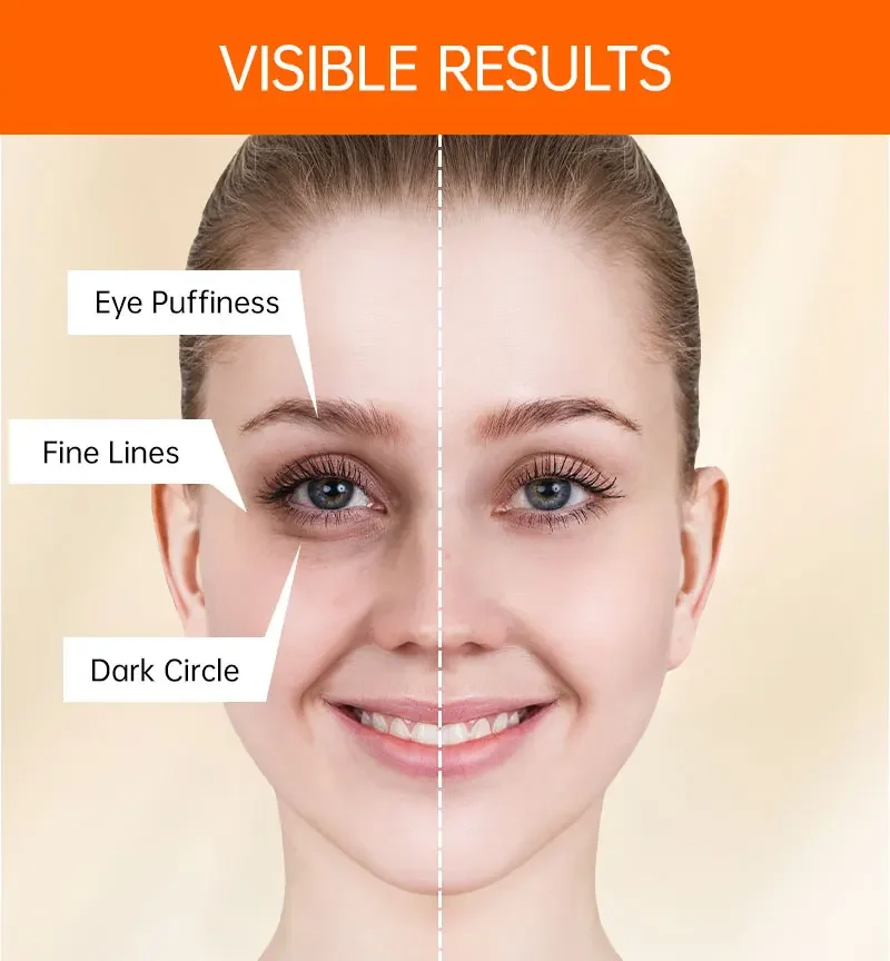 Brightening Vitamin C Eye Cream for Dark Circles