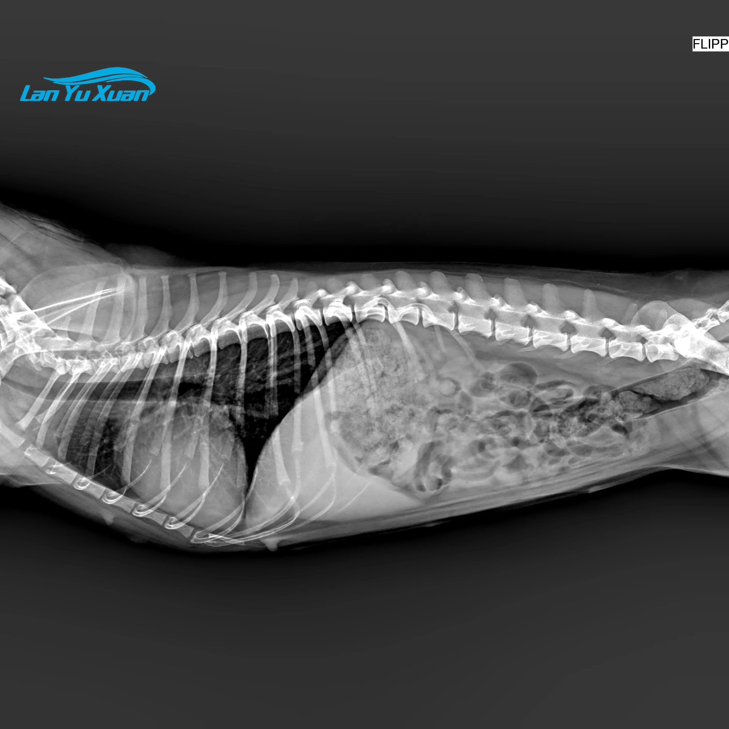 Рисунок 5 - 17*17 цифровой радиологический