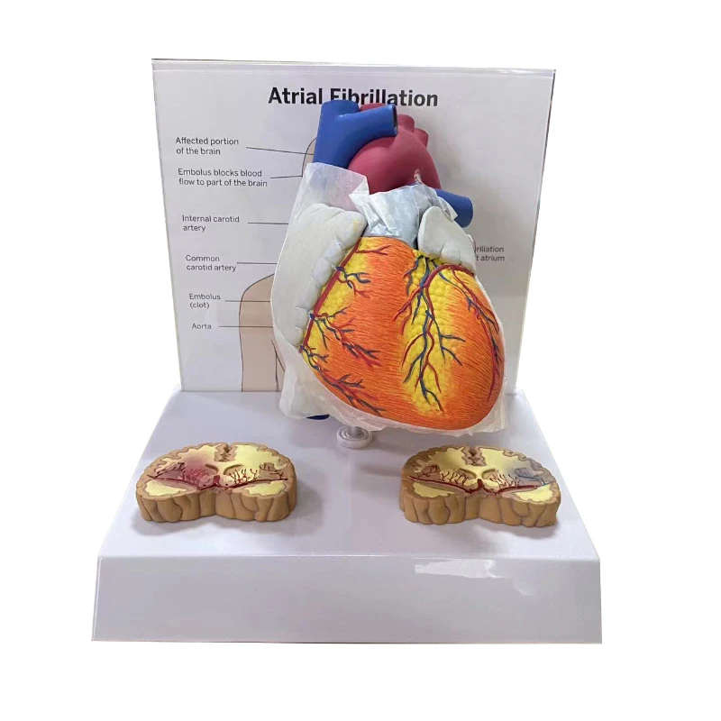 

Atriale Fibrillatie Menselijk Onderwijs Hart Anatomisch Model