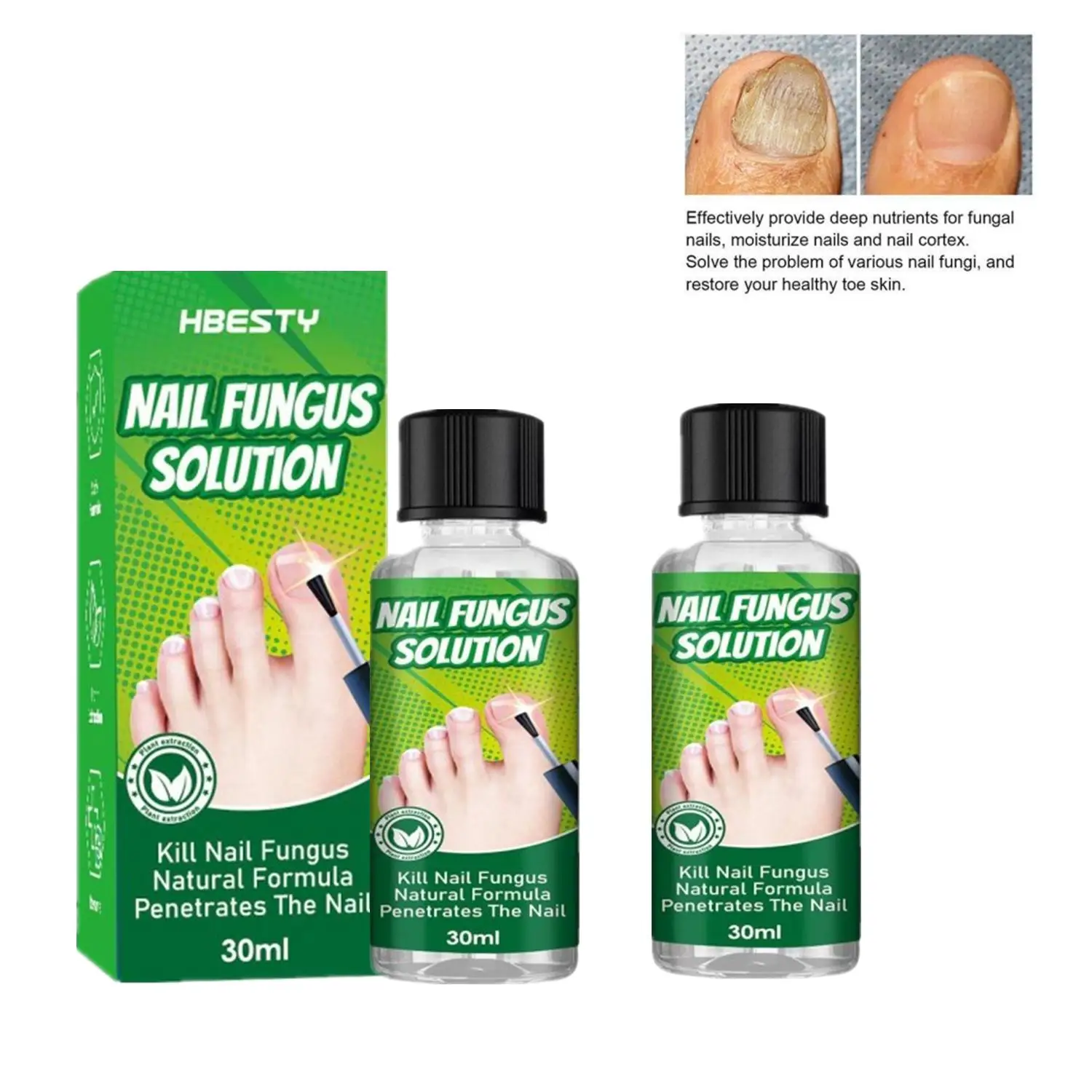 

2PCS Nail Fungus Treatment Liquid Nail Repair Serum Toenail Fingernail Anti-Fungal Repair Oil Nail Growth Polish Foot Care 30ml