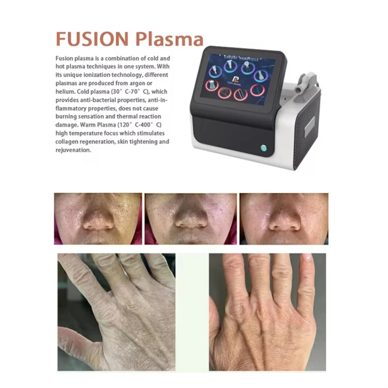 8 in 1 Fusion Plasma Cold Warm Ozone Plasma Lifting Skin Tightening Acne Remove Ozone Machine