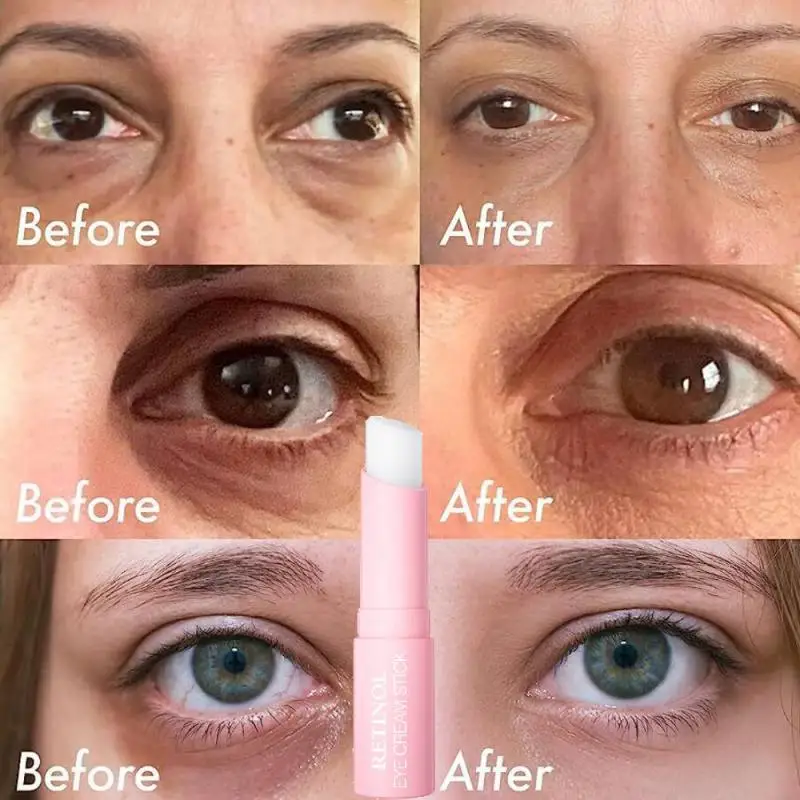 

1pc Anti-Wrinkle Eye Cream Retinol Remove Eye Bags Dark Circles Anti Aging Lifting Firming Whitening Moisturizing Brighten Skin