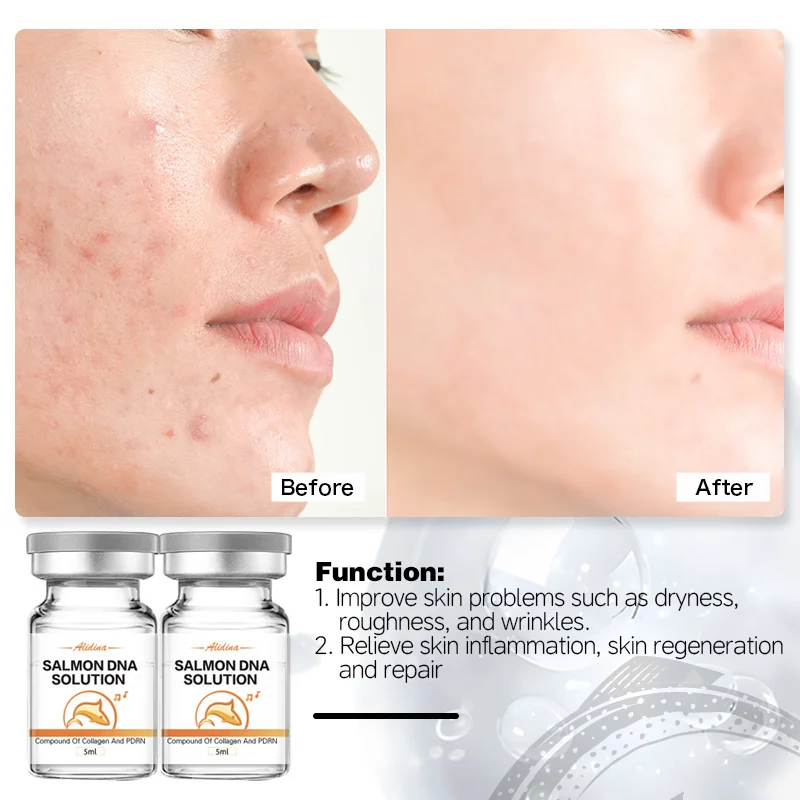 PDRN Sodium DNA Skin Booster Improve Elasticity Ance Scar Repair Serum Pore Shrink Ant-aging Brightening EGF Serum