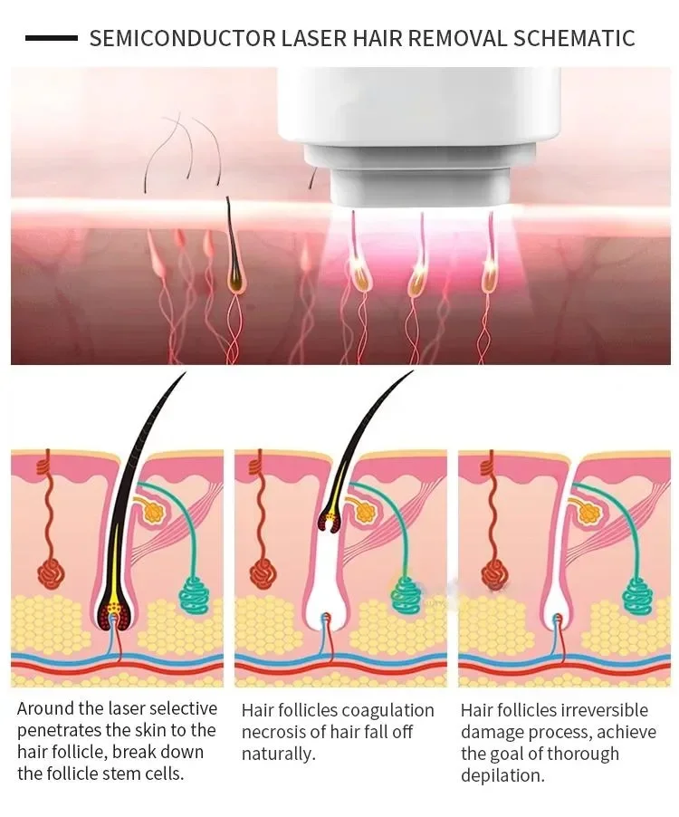 2024 profesjonalny Laser diodowy włosy maszyna do usuwania moc pachy Bikini ujęcia odmładzanie skóry Salon depilator dla kobiet CE