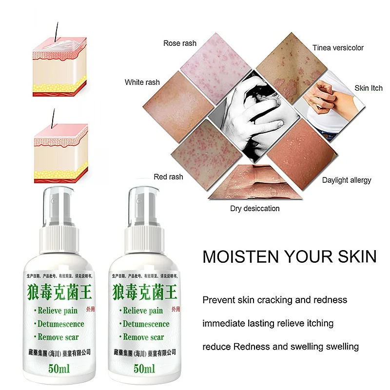 50ml Herbal Eczema Psoriasis Spray Antibacterial Dermatitis Athletes Foot Relieve Itching Irritation Allergies Skin Care