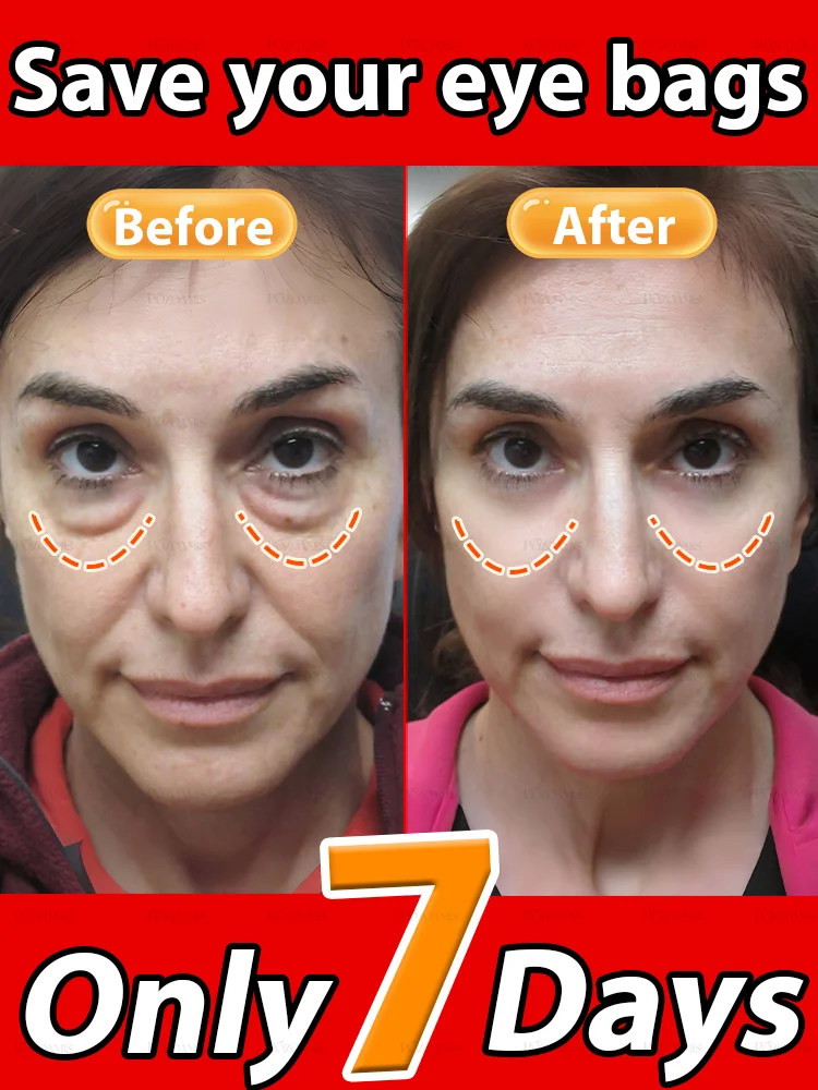 Instantly remove eye bags reduce fine lines tighten skin fight dark circles and brighten eyes anti wrinkle eye cream eye cream