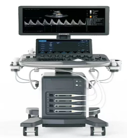 Ультразвуковая диагностическая