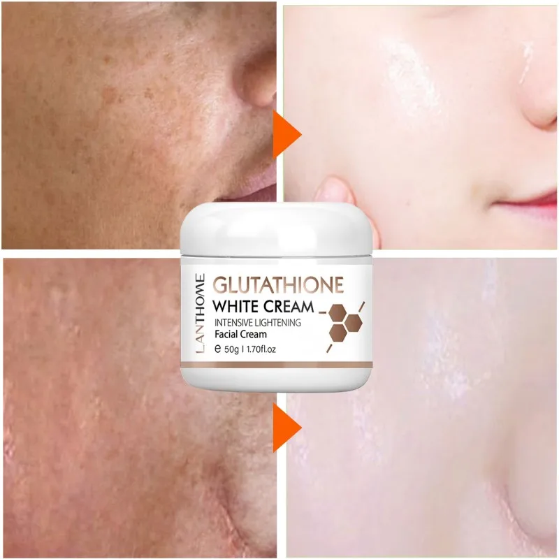 Glutathione Whitening Freckle Cream Antiaging Dark Spot Removal
