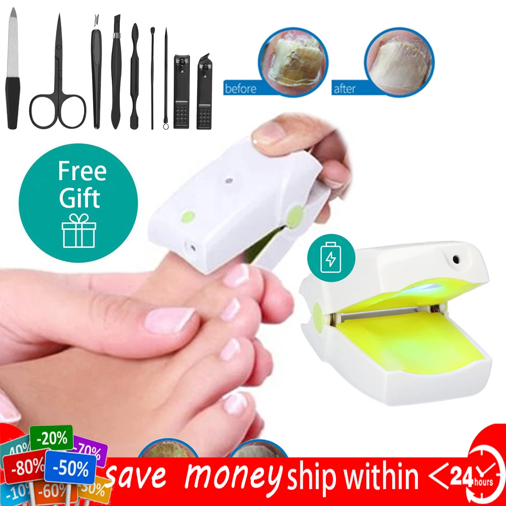 

905NM Painless Nail Fungus Treatment Instrument Laser Feet Infrared Foot Care Whitening Toe Removal anti-infective onychomycosis